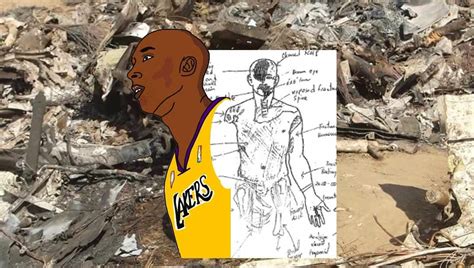 kobe bryant autopsy body|Autopsyfiles.org